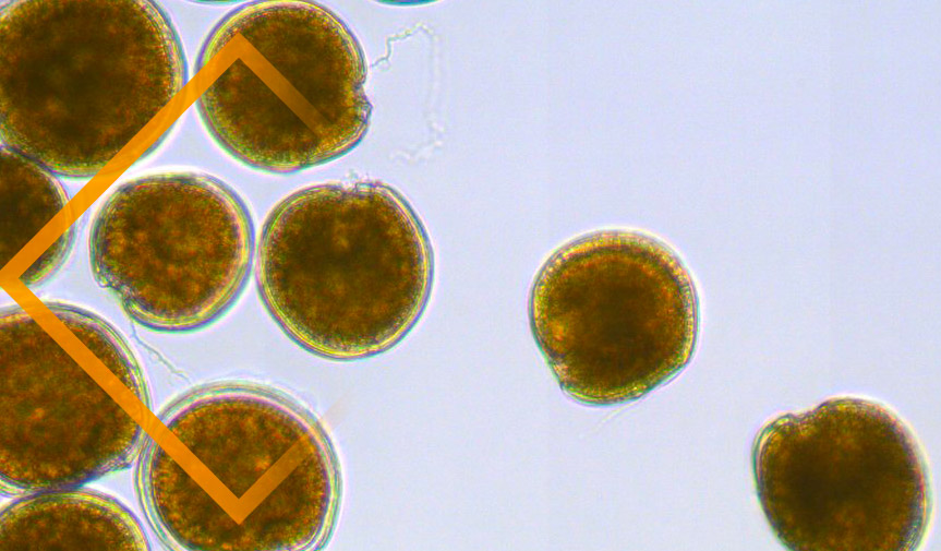 Protégé : Fiche de signalement en cas de suspicion de ciguatera